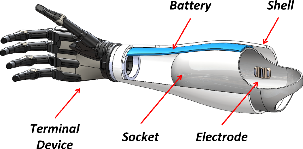 Upper limb Prosthetics :: Drizzy